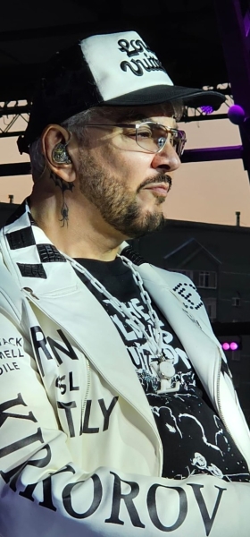 "Шрамы украшают мужчину": Киркоров рассказал о состоянии обгоревшей весной руки