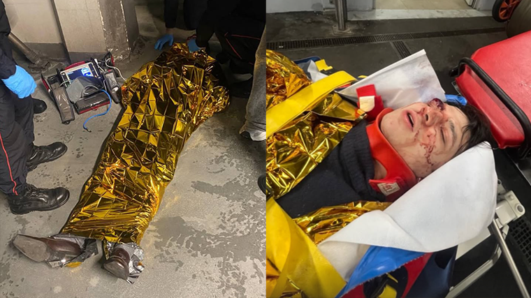 Рэпер Vacio выпал с третьего этажа и попал в реанимацию в Париже